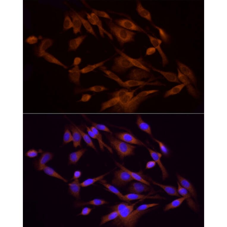 Immunofluorescence - Anti-PI 3 Kinase p85 alpha Antibody (A80663) - Antibodies.com