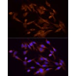 Immunofluorescence - Anti-PI 3 Kinase p85 alpha Antibody (A80663) - Antibodies.com