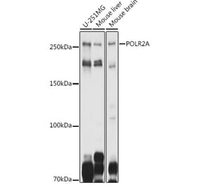 Western Blot - Anti-RNA polymerase II CTD repeat YSPTSPS Antibody (A80664) - Antibodies.com