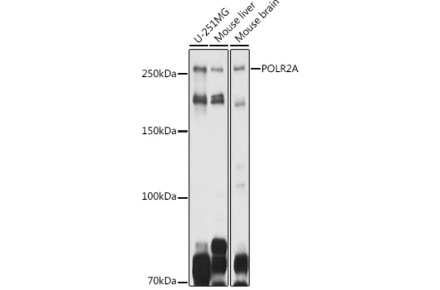 Western Blot - Anti-RNA polymerase II CTD repeat YSPTSPS Antibody (A80664) - Antibodies.com