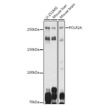 Western Blot - Anti-RNA polymerase II CTD repeat YSPTSPS Antibody (A80664) - Antibodies.com