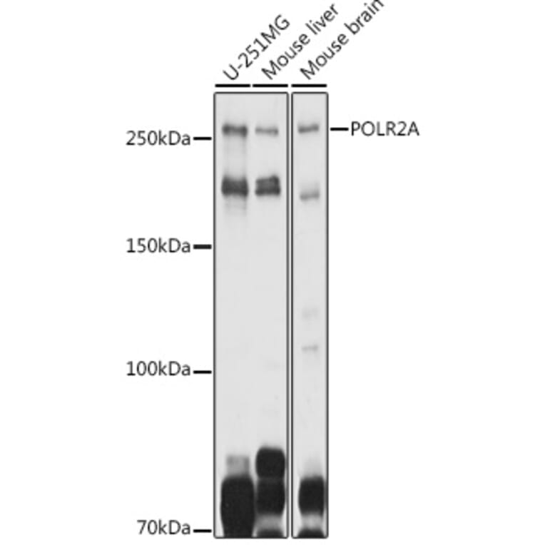 Western Blot - Anti-RNA polymerase II CTD repeat YSPTSPS Antibody (A80664) - Antibodies.com