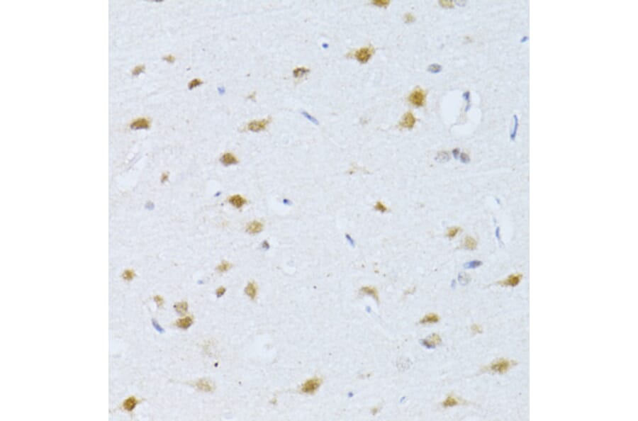 Chromatin Immunoprecipitation - Anti-RNA polymerase II CTD repeat YSPTSPS Antibody (A80664) - Antibodies.com