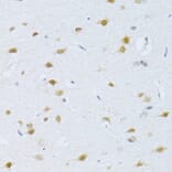 Chromatin Immunoprecipitation - Anti-RNA polymerase II CTD repeat YSPTSPS Antibody (A80664) - Antibodies.com