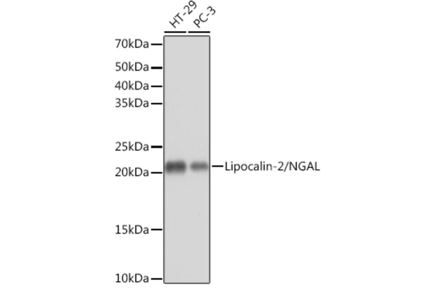 Western Blot - Anti-Lipocalin-2 / NGAL Antibody [ARC0543] (A80665) - Antibodies.com
