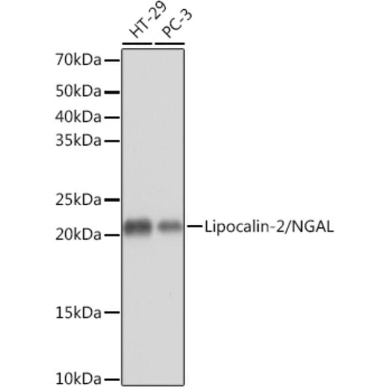 Western Blot - Anti-Lipocalin-2 / NGAL Antibody [ARC0543] (A80665) - Antibodies.com