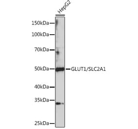 Western Blot - Anti-Glucose Transporter GLUT1 Antibody (A80666) - Antibodies.com