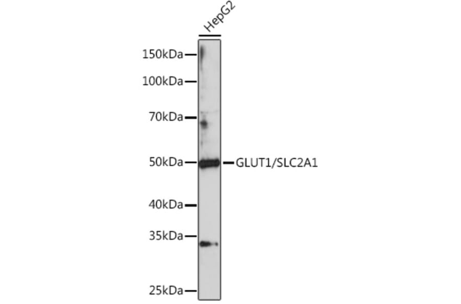 Western Blot - Anti-Glucose Transporter GLUT1 Antibody (A80666) - Antibodies.com