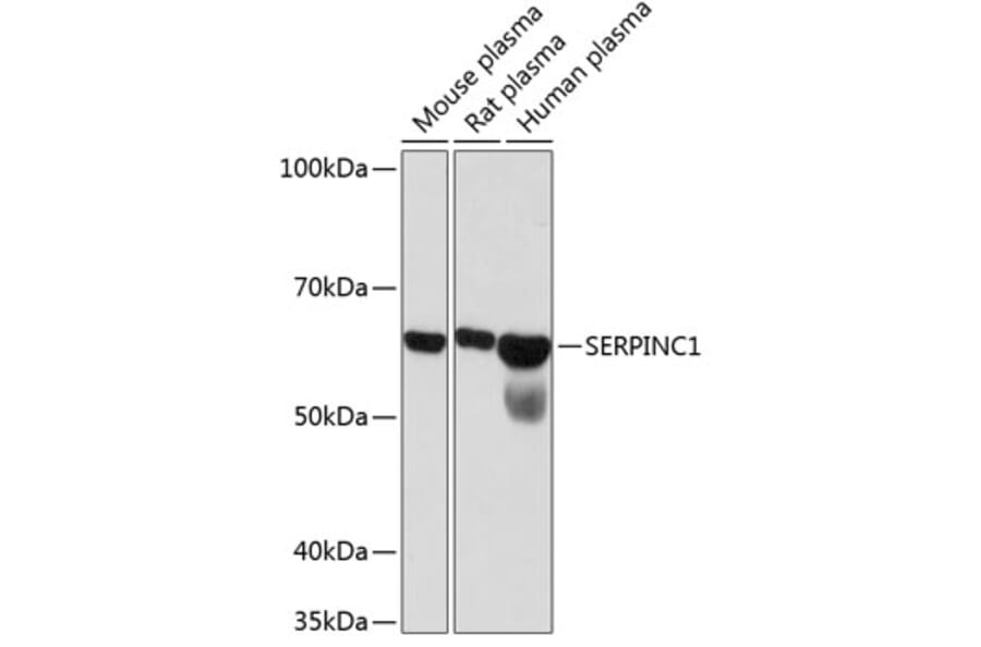 Western Blot - Anti-Antithrombin III/ATIII Antibody [ARC0559] (A80667) - Antibodies.com