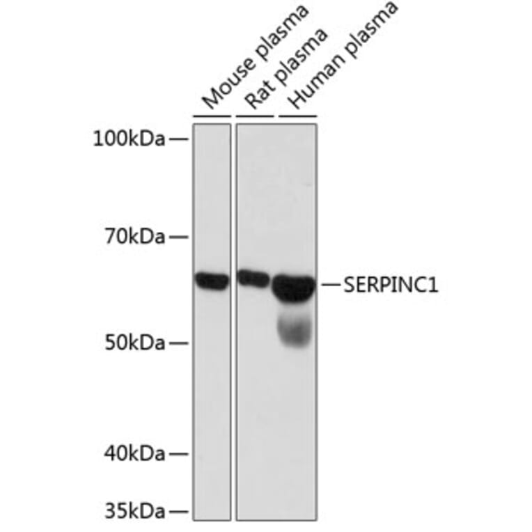 Western Blot - Anti-Antithrombin III/ATIII Antibody [ARC0559] (A80667) - Antibodies.com