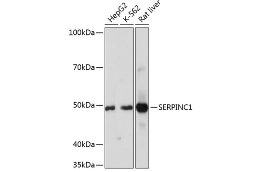 Western Blot - Anti-Antithrombin III/ATIII Antibody [ARC0559] (A80667) - Antibodies.com