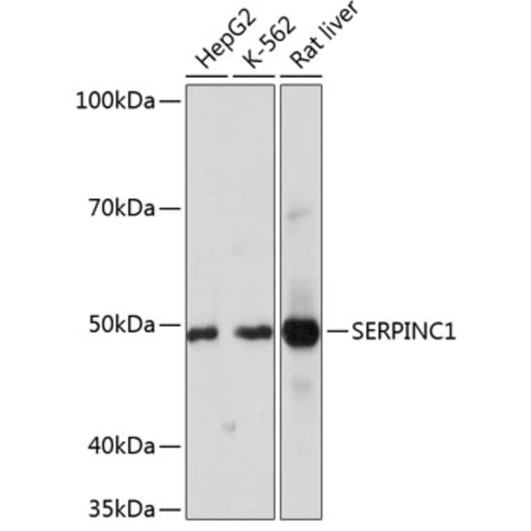 Western Blot - Anti-Antithrombin III/ATIII Antibody [ARC0559] (A80667) - Antibodies.com