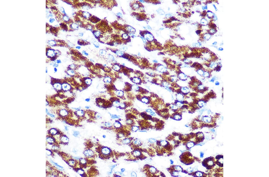Immunohistochemistry - Anti-Antithrombin III/ATIII Antibody [ARC0559] (A80667) - Antibodies.com