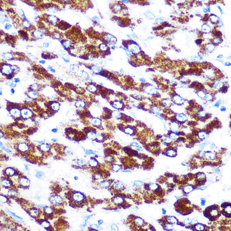Immunohistochemistry - Anti-Antithrombin III/ATIII Antibody [ARC0559] (A80667) - Antibodies.com