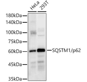 Western Blot - Anti-SQSTM1 / p62 Antibody (A80668) - Antibodies.com