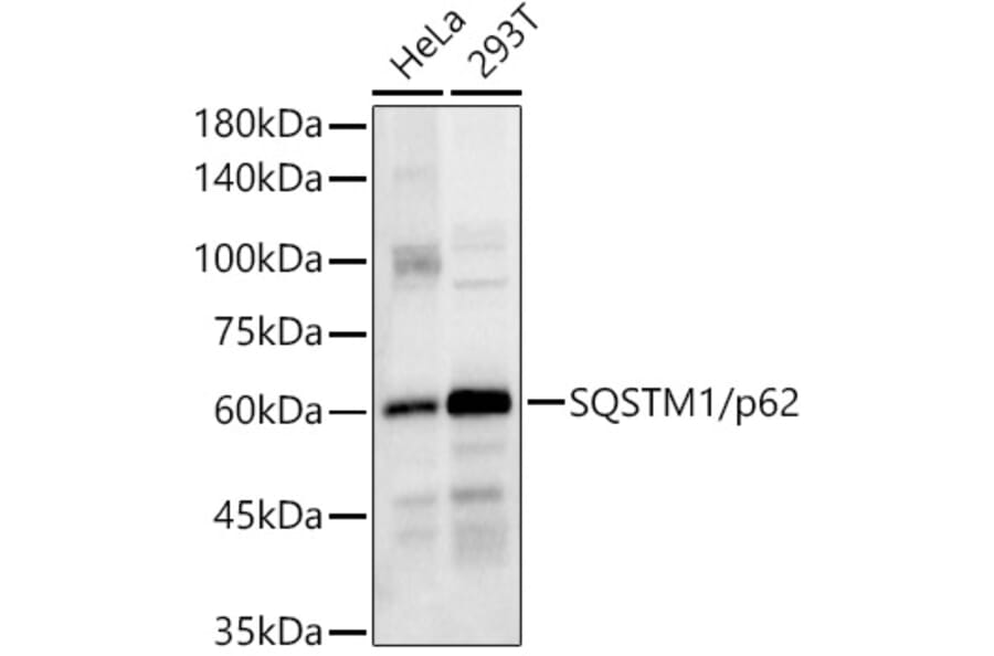 Western Blot - Anti-SQSTM1 / p62 Antibody (A80668) - Antibodies.com