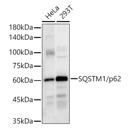 Western Blot - Anti-SQSTM1 / p62 Antibody (A80668) - Antibodies.com