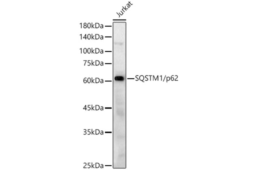 Western Blot - Anti-SQSTM1 / p62 Antibody (A80668) - Antibodies.com