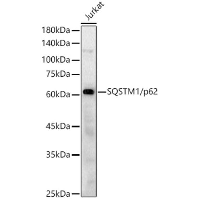 Western Blot - Anti-SQSTM1 / p62 Antibody (A80668) - Antibodies.com