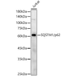 Western Blot - Anti-SQSTM1 / p62 Antibody (A80668) - Antibodies.com
