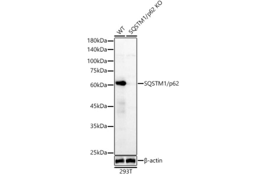 Western Blot - Anti-SQSTM1 / p62 Antibody (A80668) - Antibodies.com