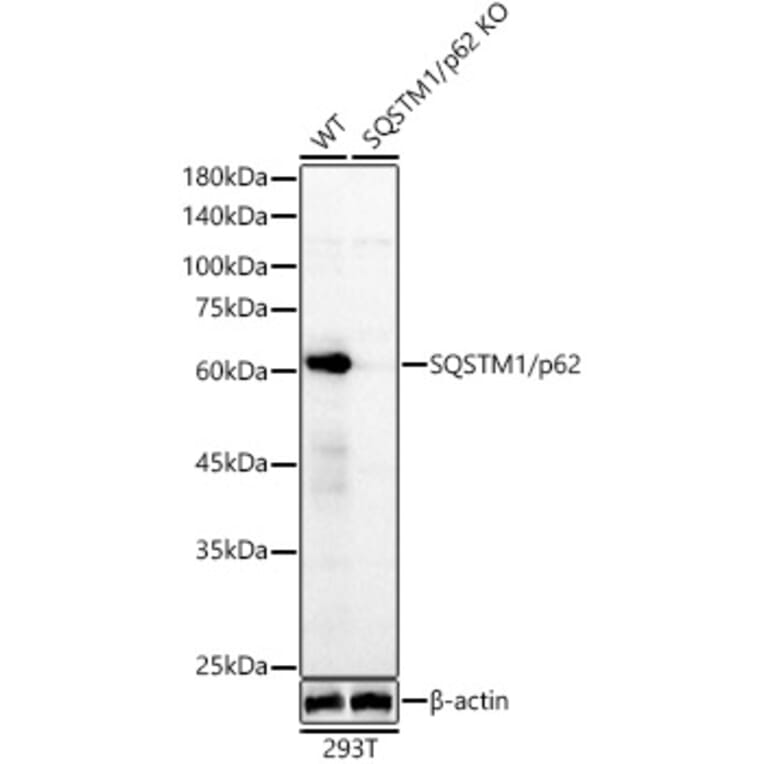 Western Blot - Anti-SQSTM1 / p62 Antibody (A80668) - Antibodies.com