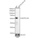 Western Blot - Anti-SQSTM1 / p62 Antibody (A80668) - Antibodies.com