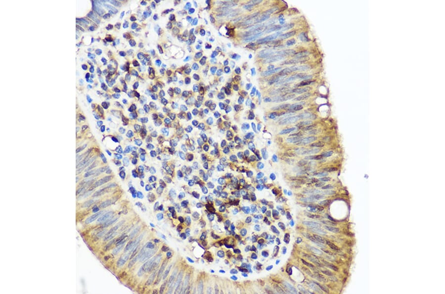 Immunohistochemistry - Anti-SQSTM1 / p62 Antibody (A80668) - Antibodies.com