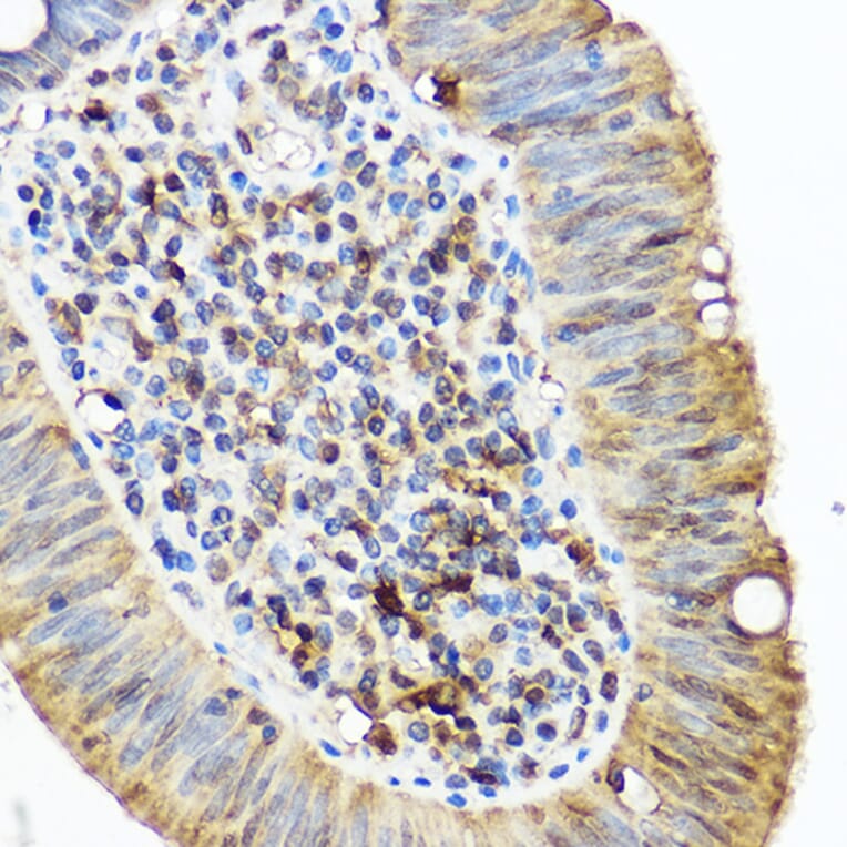 Immunohistochemistry - Anti-SQSTM1 / p62 Antibody (A80668) - Antibodies.com