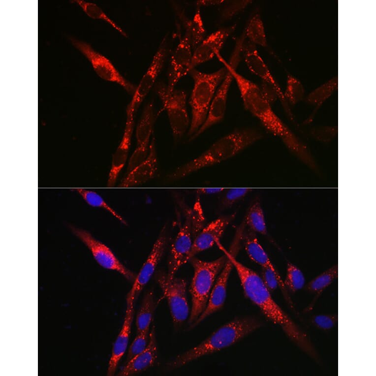 Immunofluorescence - Anti-SQSTM1 / p62 Antibody (A80668) - Antibodies.com