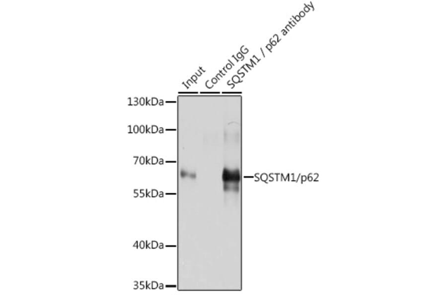 Western Blot - Anti-SQSTM1 / p62 Antibody (A80668) - Antibodies.com