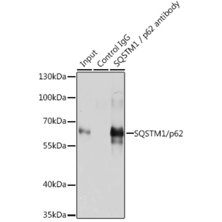 Western Blot - Anti-SQSTM1 / p62 Antibody (A80668) - Antibodies.com