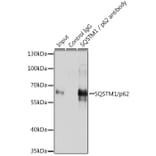 Western Blot - Anti-SQSTM1 / p62 Antibody (A80668) - Antibodies.com