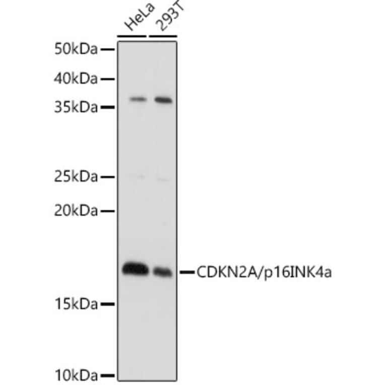 Western Blot - Anti-CDKN2A/p16INK4aF Antibody (A80670) - Antibodies.com
