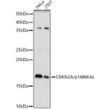 Western Blot - Anti-CDKN2A/p16INK4aF Antibody (A80670) - Antibodies.com