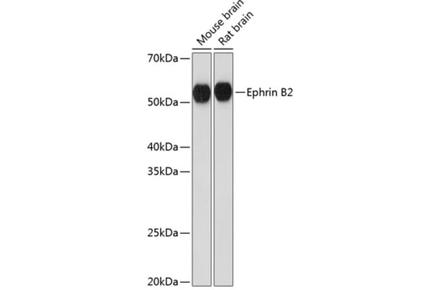 Western Blot - Anti-Ephrin B2 Antibody [ARC0576] (A80671) - Antibodies.com