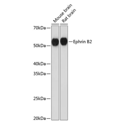 Western Blot - Anti-Ephrin B2 Antibody [ARC0576] (A80671) - Antibodies.com