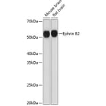 Western Blot - Anti-Ephrin B2 Antibody [ARC0576] (A80671) - Antibodies.com