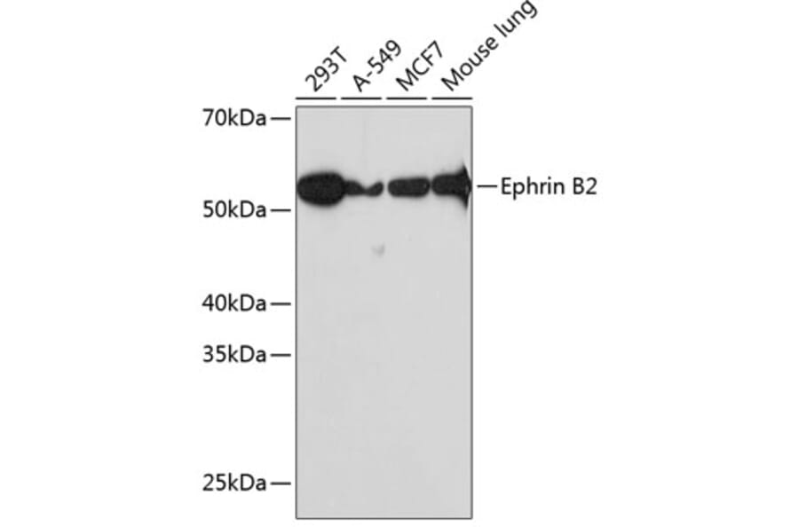 Western Blot - Anti-Ephrin B2 Antibody [ARC0576] (A80671) - Antibodies.com