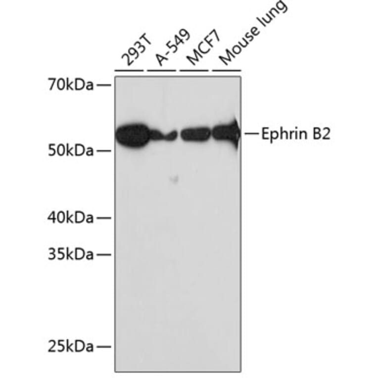 Western Blot - Anti-Ephrin B2 Antibody [ARC0576] (A80671) - Antibodies.com