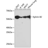 Western Blot - Anti-Ephrin B2 Antibody [ARC0576] (A80671) - Antibodies.com