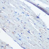 Immunohistochemistry - Anti-Ephrin B2 Antibody [ARC0576] (A80671) - Antibodies.com