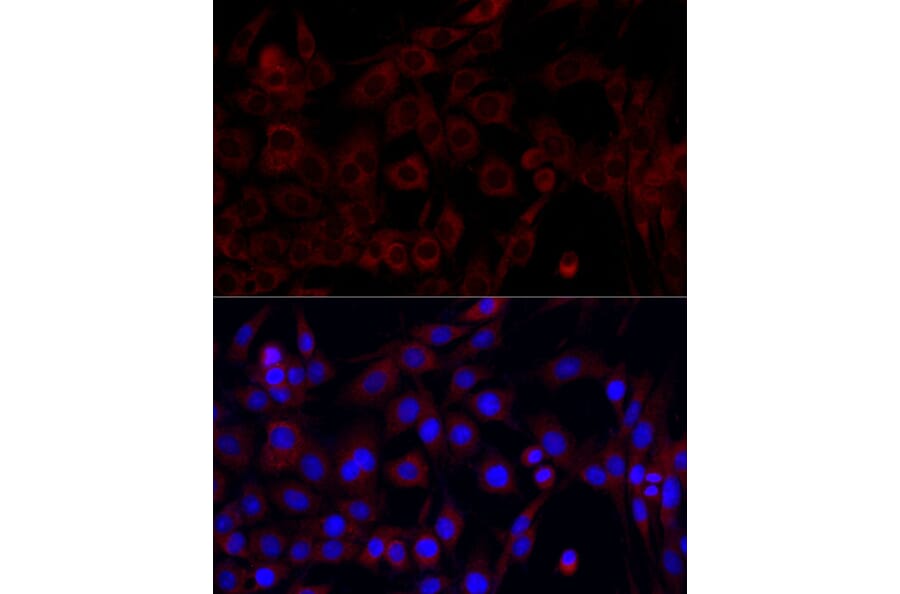 Immunofluorescence - Anti-PI 3 Kinase p85 alpha Antibody (A80672) - Antibodies.com