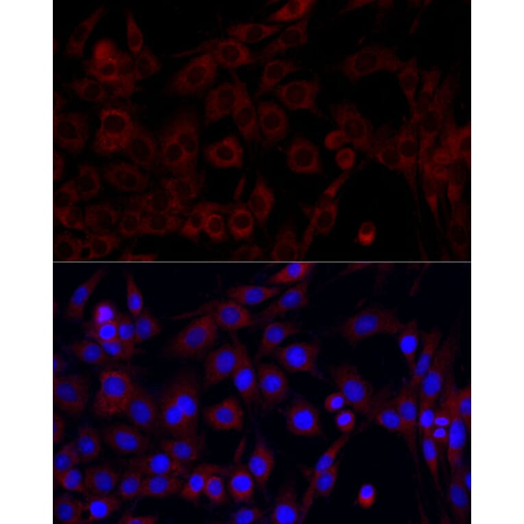 Immunofluorescence - Anti-PI 3 Kinase p85 alpha Antibody (A80672) - Antibodies.com