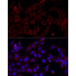 Immunofluorescence - Anti-PI 3 Kinase p85 alpha Antibody (A80672) - Antibodies.com