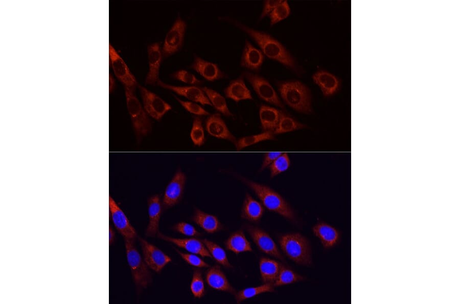 Immunofluorescence - Anti-PI 3 Kinase p85 alpha Antibody (A80672) - Antibodies.com