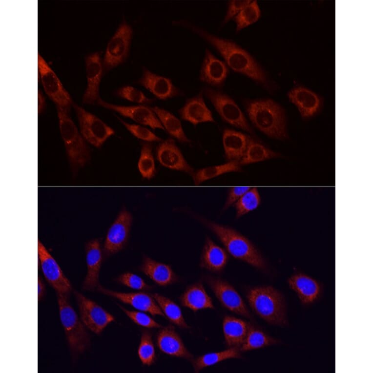 Immunofluorescence - Anti-PI 3 Kinase p85 alpha Antibody (A80672) - Antibodies.com