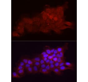 Immunofluorescence - Anti-Fbx32 Antibody (A80674) - Antibodies.com