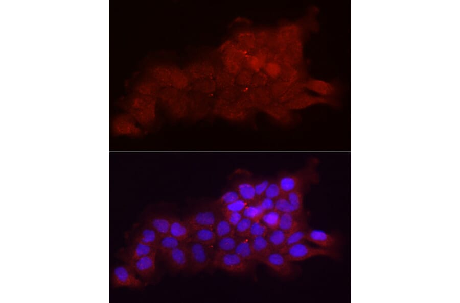 Immunofluorescence - Anti-Fbx32 Antibody (A80674) - Antibodies.com