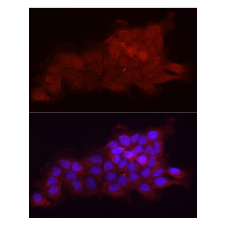 Immunofluorescence - Anti-Fbx32 Antibody (A80674) - Antibodies.com